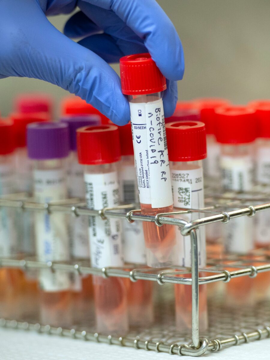 Long Beach settles employee’s lawsuit over religious exemption for coronavirus testing