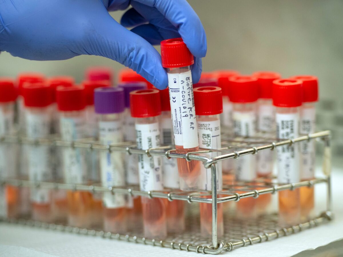 A worker tests samples for the new coronavirus in Los Angeles County's lab. Photo courtesy Los Angeles County.