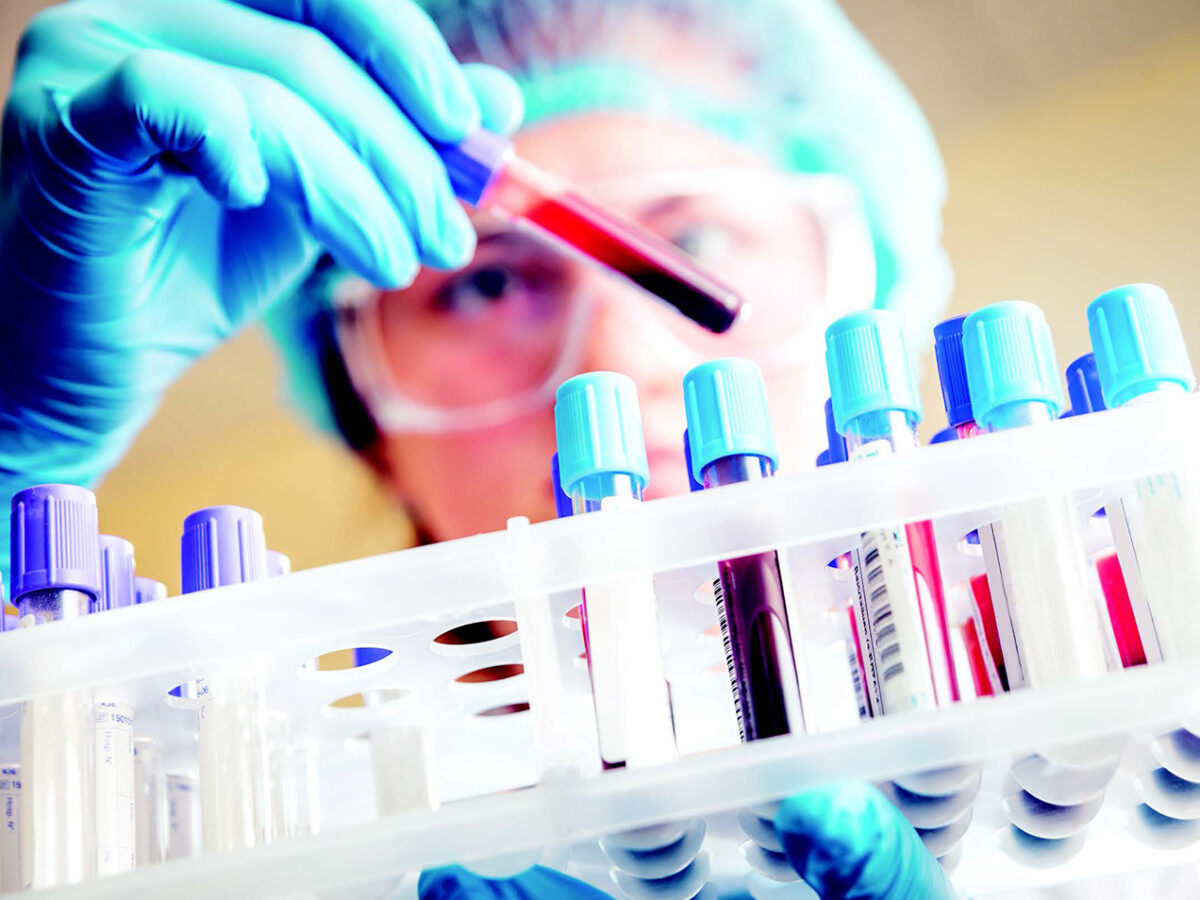 Innovative REACH study enhances early cancer detection